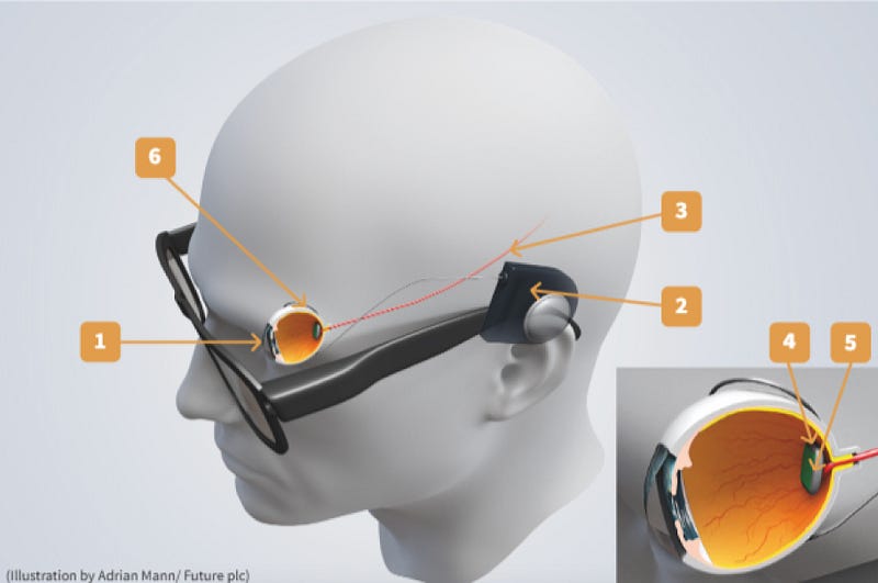 Diagram explaining bionic eye functionality