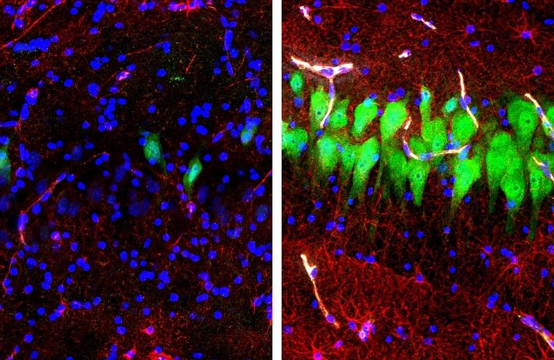 Revived pig brain cells showcasing restored functions